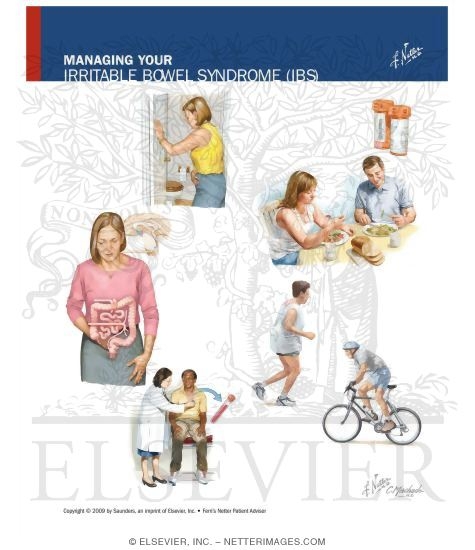 Managing Your Irritable Bowel Syndrome (IBS)