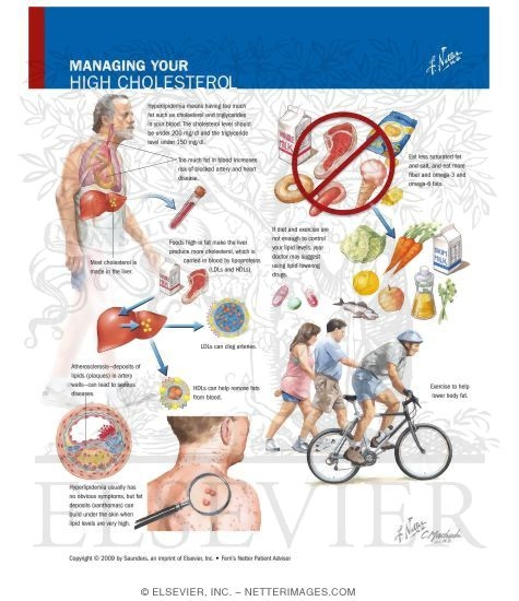Watermarked preview of labeled image: Managing Your High Cholesterol