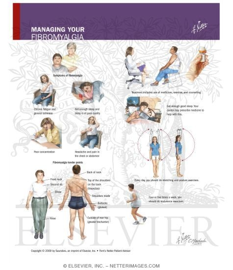 Watermarked preview of labeled image: Managing Your Fibromyalgia