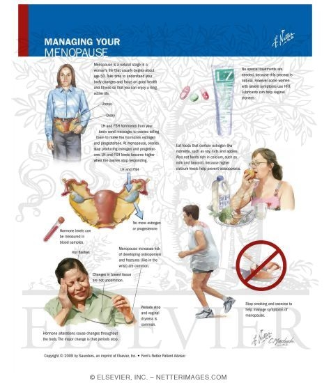 Watermarked preview of labeled image: Managing Your Menopause