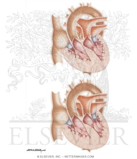 Watermarked preview of unlabeled image: Surgery for Congenital Heart Disease