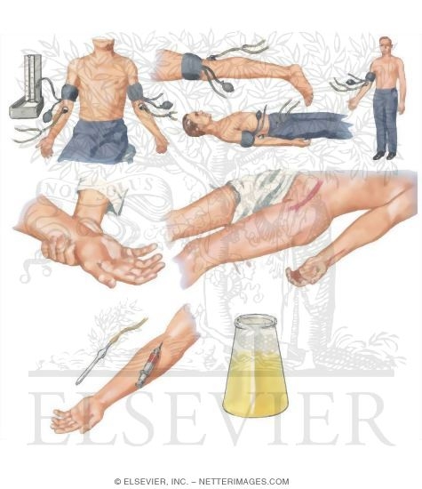 Watermarked preview of unlabeled image: Routine Studies for the Hypertensive Patient