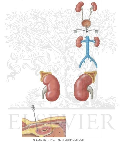 Watermarked preview of unlabeled image: Special Tests for the Hypertensive Patient