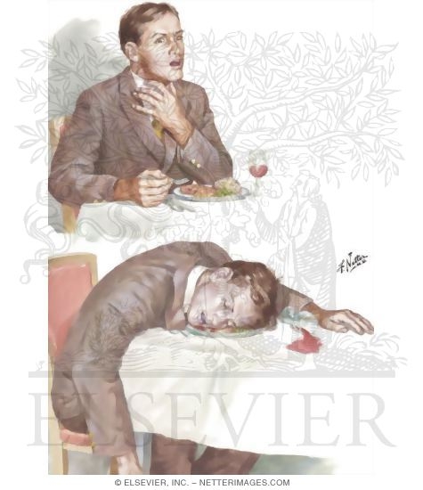 Recognizing the Choking Victim