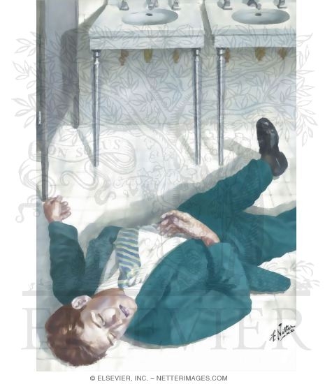 Watermarked preview of unlabeled image: Airway Obstruction: Prostrate Victim
