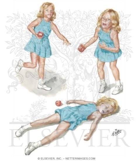 Watermarked preview of unlabeled image: Obstructed Airway: Child Victim