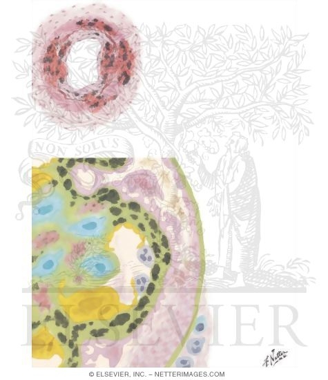 Watermarked preview of unlabeled image: Pathology of Complex Deposition