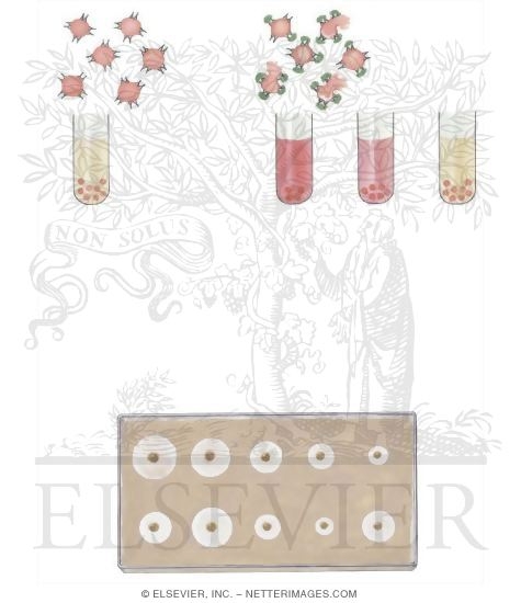 Watermarked preview of unlabeled image: Measurement of Complement Levels