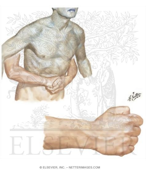 Position of Hands In Heimlich Maneuver