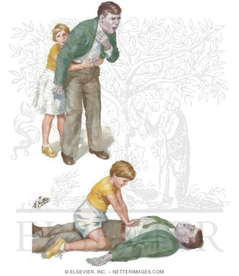 Watermarked preview of unlabeled image: Adult Victim With Child Rescuer Performing Heimlich Maneuver