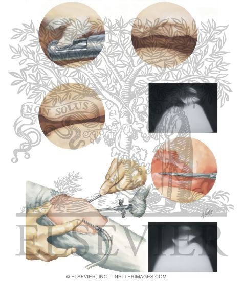 Watermarked preview of unlabeled image: Arthroscopic Surgery of the Patella