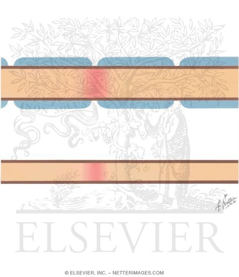 Watermarked preview of unlabeled image: Conduction Velocity