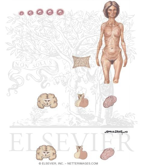 Watermarked preview of unlabeled image: Current Perspectives In Gynecology: Hypothalmic Amenorrhea