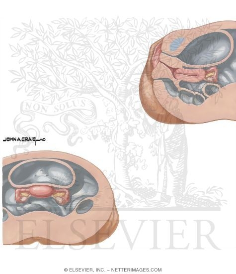 Current Perspectives In Gynecology: Real-Time Pelvic Ultrasonography