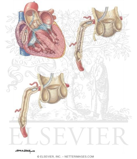 Fibrinolytic Disorders