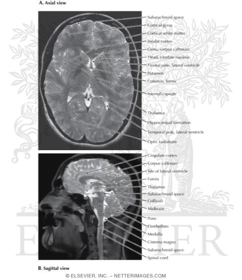 Watermarked preview of labeled image: Brain Imaging: Magnetic Resonance Imaging, Axial and Sagittal T2-Weighted Images