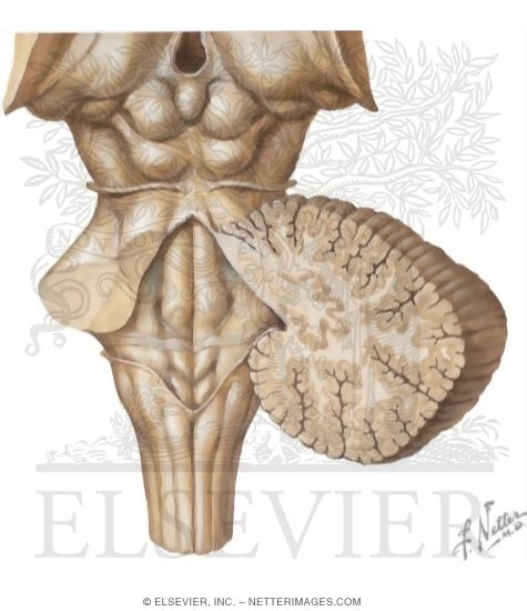 Anatomy Of The Fourth Ventricle: Posterior View With Cerebellum Removed