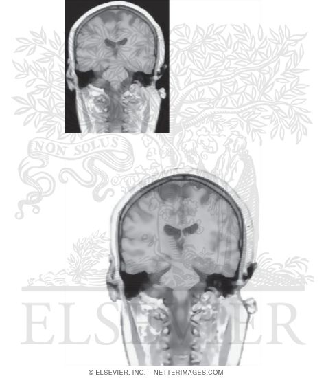 Watermarked preview of unlabeled image: Coronal Sections Through the Forebrain: Level 7 - Midthalamus