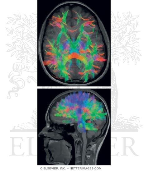 Color Imaging of Association Pathways