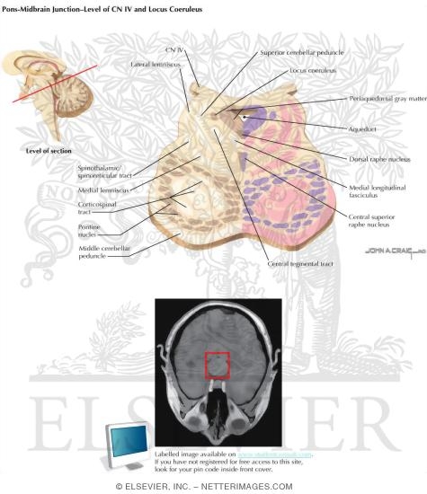 Pons-Midbrain Junction - Level of CN IV and Locus Coeruleus