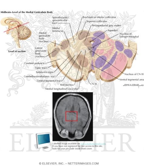 Midbrain - Level of the Medial Geniculate Body