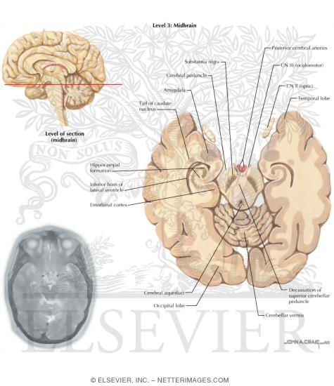 Horizontal Sections Through the Forebrain: Midbrain