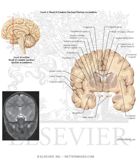 Coronal Sections Through the Forebrain: Head of Caudate Nucleus/Nucleus Accumbens