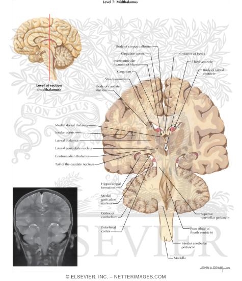 Coronal Sections Through the Forebrain: Midthalamus