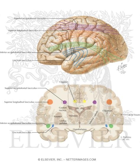 Watermarked preview of labeled image: Major Cortical Association Bundles