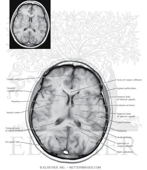 Watermarked preview of labeled image: Axial (Horizontal) Sections Through the Forebrain: Level 7 - Basal Ganglia and Internal Capsule