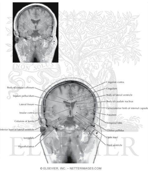 Coronal Sections Through the Forebrain: Level 4 - Amygdala, Anterior Limb of Internal Capsule