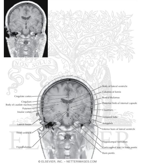 Coronal Sections Through the Forebrain: Level 5 - Mammillary Body