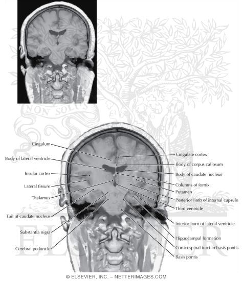 Coronal Sections Through the Forebrain: Level 6 - Mammillothalamic Tract and Substantia Nigra, Rostral Hippocampus