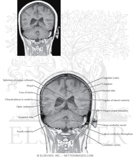 Coronal Sections Through the Forebrain: Level 10 - Splenium of Corpus Callosum
