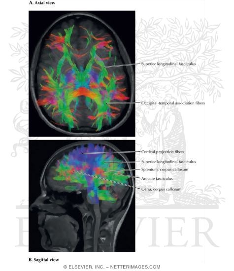 Color Imaging of Association Pathways