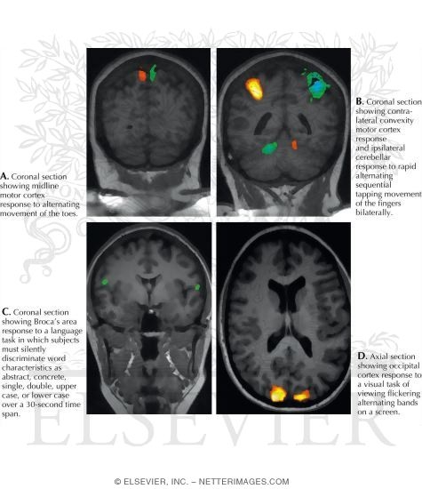 Watermarked preview of unlabeled image: Functional Magnetic Resonance Imaging