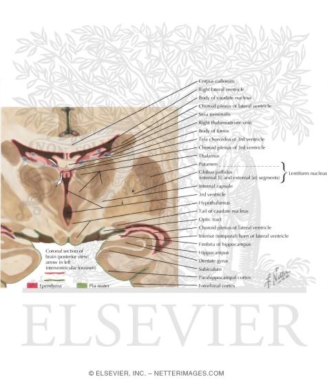 Watermarked preview of labeled image: Ventricular Anatomy In Coronal Forebrain Section