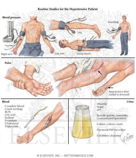 Watermarked preview of labeled image: Routine Studies for the Hypertensive Patient