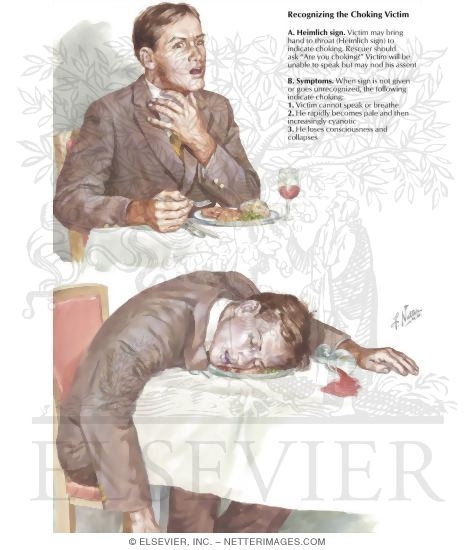 Watermarked preview of labeled image: Recognizing the Choking Victim