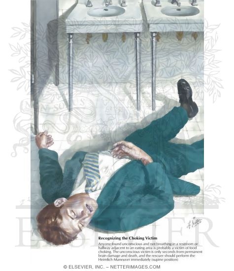 Watermarked preview of labeled image: Airway Obstruction: Prostrate Victim