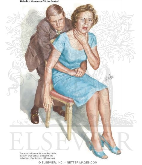 Watermarked preview of labeled image: Heimlich Maneuver: Adult Victim, Seated