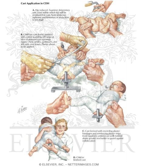 Watermarked preview of labeled image: Cast Application