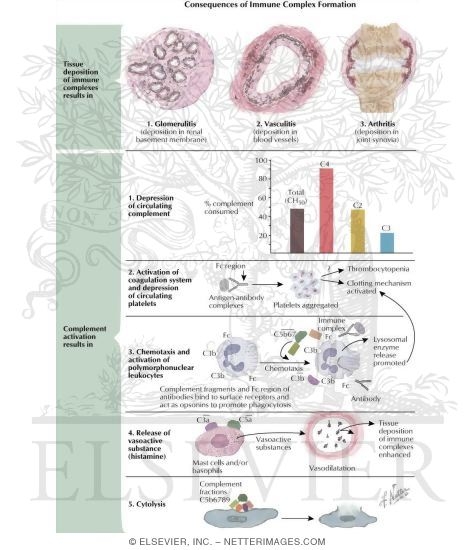 Watermarked preview of labeled image: Consequences of Immune Complexes