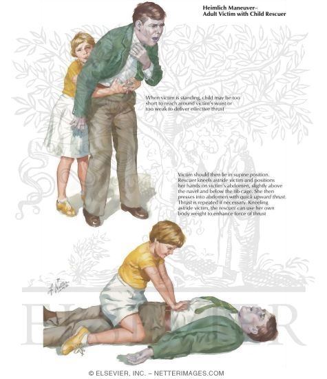 Watermarked preview of labeled image: Adult Victim With Child Rescuer Performing Heimlich Maneuver