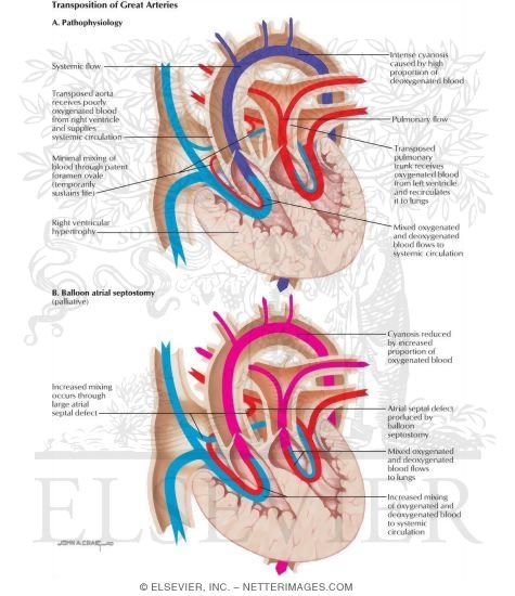 Watermarked preview of labeled image: Surgery for Congenital Heart Disease