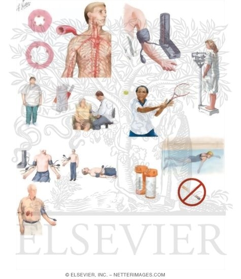 Watermarked preview of unlabeled image: Managing Your High Blood Pressure (Hypertension)