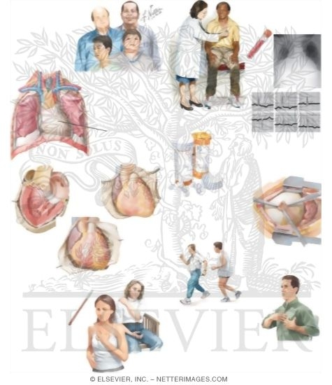 Watermarked preview of unlabeled image: Managing Your Pericarditis