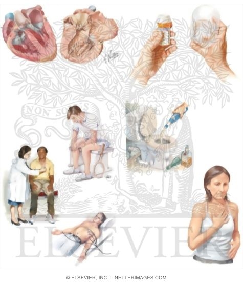 Watermarked preview of unlabeled image: Managing Your Restrictive Cardiomyopathy