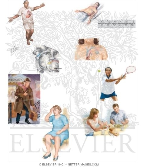 Watermarked preview of unlabeled image: Managing Your Second-Degree Heart Block