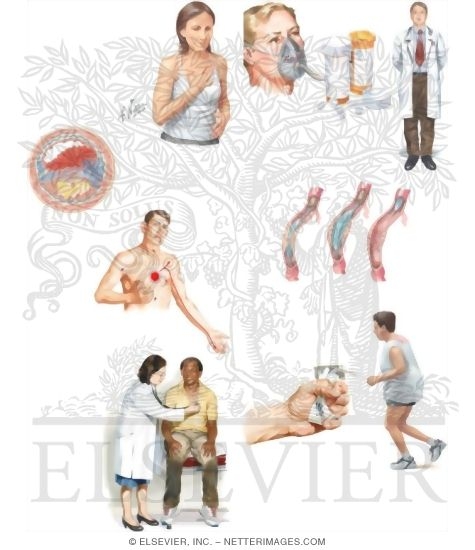 Watermarked preview of unlabeled image: Managing Your Unstable Angina